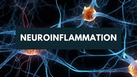 Neuroinflammation | Support Fibromyalgia Network