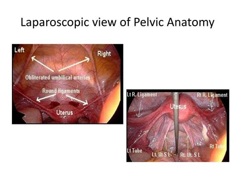 Ppt Pelvic Surgical Anatomy Powerpoint Presentation Free Download