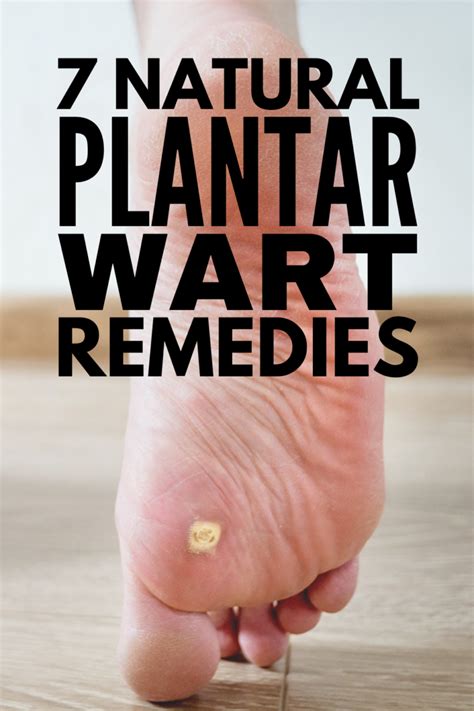 Home Remedies that Work: 7 Natural Treatments for Plantar Warts