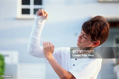 Young Boy With Arm In Cast High Res Stock Photo Getty Images