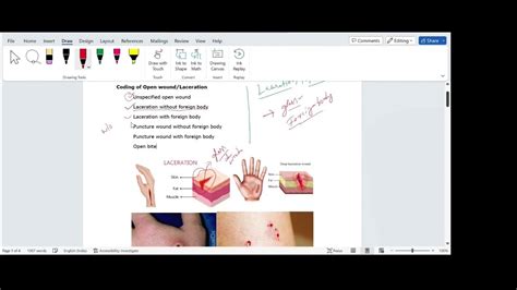 Icd 10 Cmcpt Coding Of Lacerationsopen Wound Part 1 Youtube