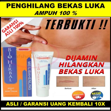 Jual Penghilang Bekas Luka Hitam Koreng Obat Penghilang Bekas Luka