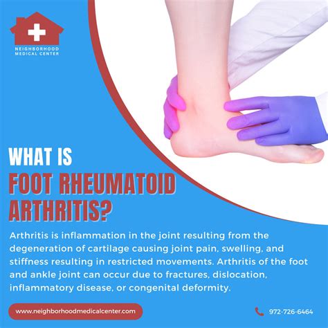 What Is Foot Rheumatoid Arthritis Dallas Texas Neighborhood Medical