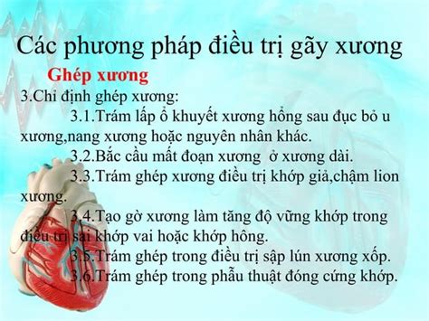 B Dc Gay Xuong B Nh Ngo I Khoa Ppt