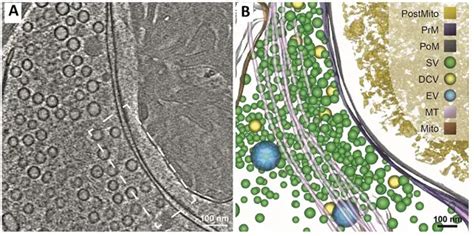 Cryo Electron Microscopy Principle Procedure Advantages