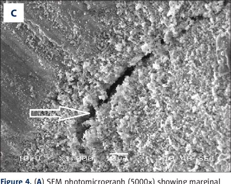 PDF A Scanning Electron Microscopy Study Comparing 3 Obturation