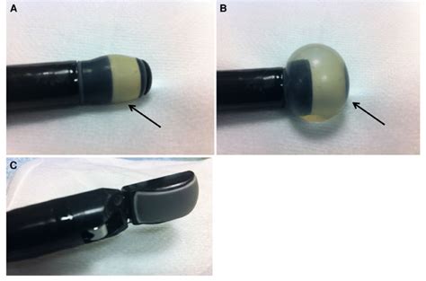 Examples Of Endoscopic Ultrasound Echoendoscopes A Radial Probe With