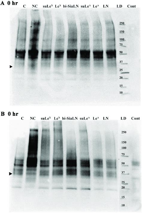 Sperm Protein Tyrosine Phosphorylation Increases During Capacitation