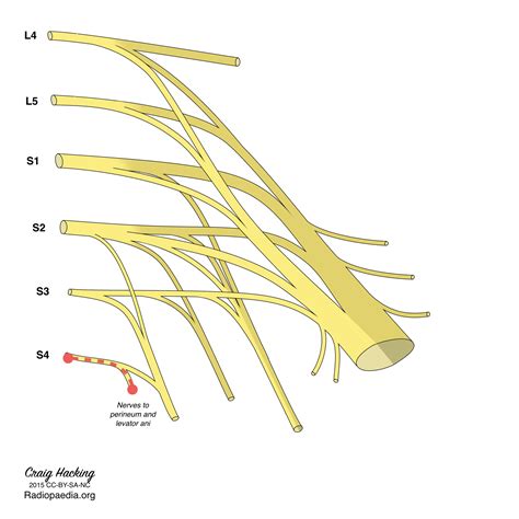 Sacral Plexus Diagram Image Radiopaedia Org