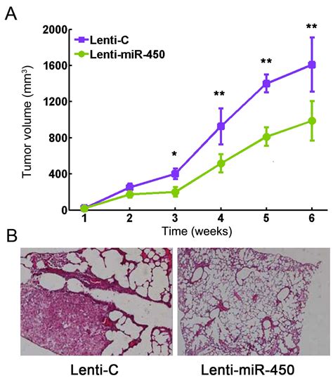 Upregulation Of MicroRNA 450 Inhibits The Progression Of Lung Cancer In