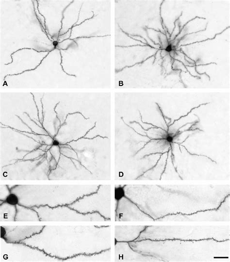 A D Photomicrographs Illustrating Individual Pyramidal Neurons In