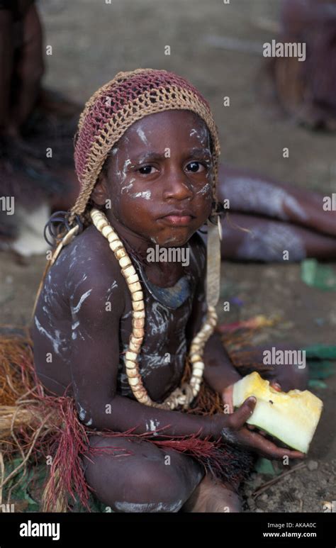 Child Malnutrition Hi Res Stock Photography And Images Alamy