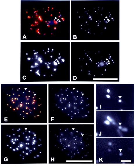 Figure 4 From Centromere Kinetochore Localization Of Human Centromere