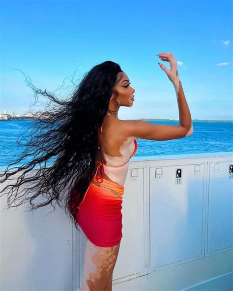 Winnie Harlow Spread Her Legs Wide In Tiny Bikini Photos The Fappening