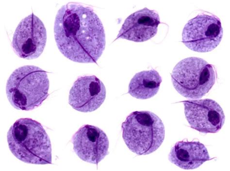 Trichomonas Vaginalis Microscope