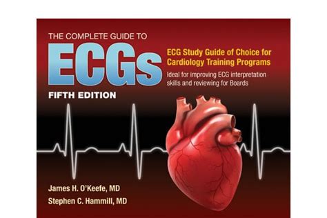 The ECG Book You've Been Looking For