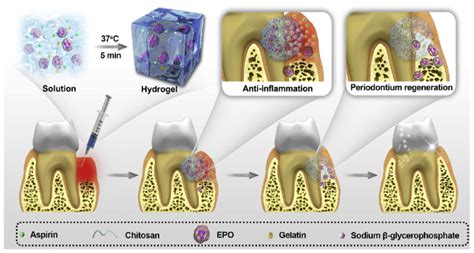 Injectable Biomaterials for Dental Tissue Regeneration