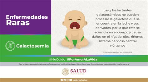 SALUD México on Twitter EnfermedadesRaras I Galactosemia La