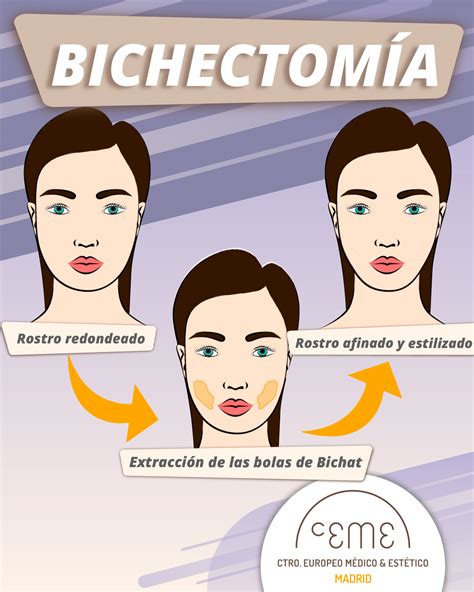 Bitchetomia BICHECTOMÍA ANTES Y DESPUÉS Ceme silverbureau ma