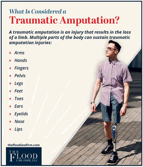 Connecticut Amputation Injury Attorneys The Flood Law Firm