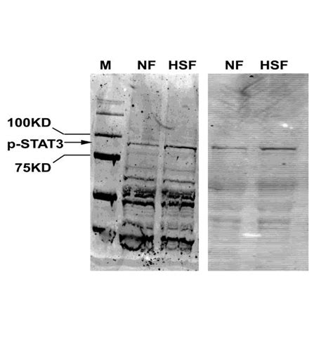 Figure S3 Western Immunoblot Analysis Of Phospho STAT3 Tyr 705 In