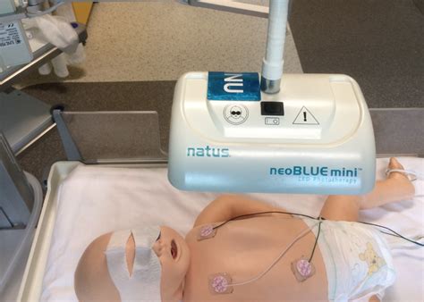 Phototherapy For Neonatal Jaundice Nejm