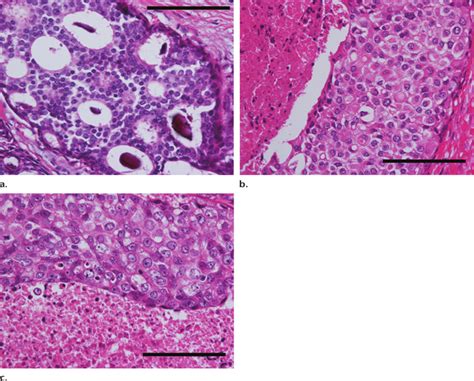 Photomicrographs Original Magnification Hematoxylin Eosin H E