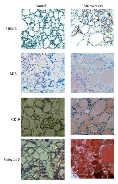 Effect Of Microgravity On Hbme Mib Ck And Galectin A