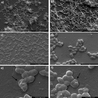 Scanning Electron Microscopy Images Of Enterococcus Faecalis Atcc