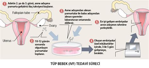 Tüp Bebek IVF Tedavisi