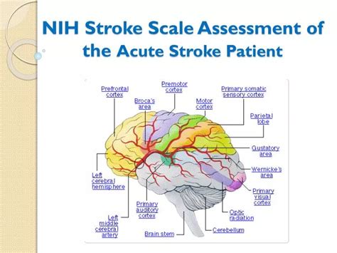 Ppt Nih Stroke Scale Assessment Of The Acute Stroke Patient