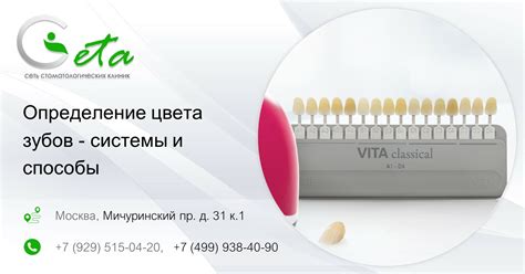 Определение цвета зубов - системы и способы