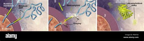 Amyloid plaque hi-res stock photography and images - Alamy