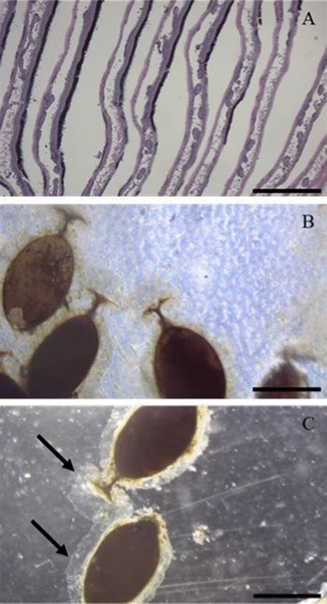 A Normal Histology Of Gill Lamella Not Impacted By B Candida Cocoons