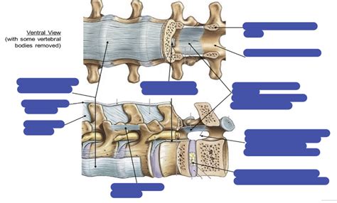 Vertebral Ligaments Diagram Quizlet