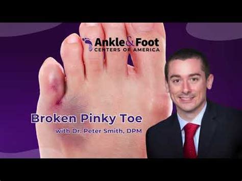 Broken Pinky Toe Fractures Ankle Foot Centers Of America