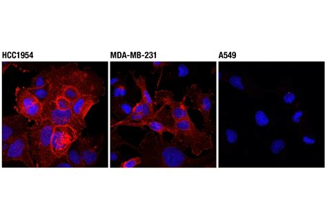 Pd L1 Extracellular Domain Specific D8t4x Rabbit Mab Alexa Fluor