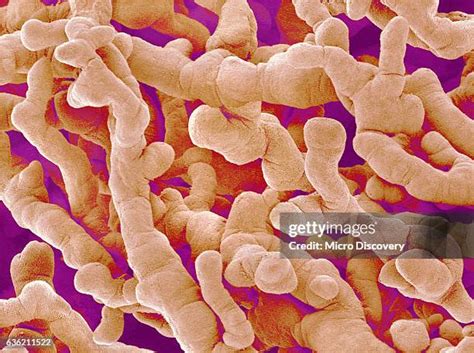 1588 Images Of A Placenta Stock Photos High Res Pictures And Images
