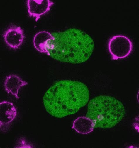 Parasitic Amoeba Chomps On Human Cells To Kill Them Live Science