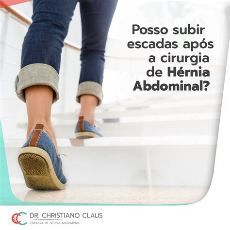30 Dias Após Cesárea Pode Subir Escada - Posso Subir Escadas Após Cirurgia De Hérnia Umbilical - BRAINCP