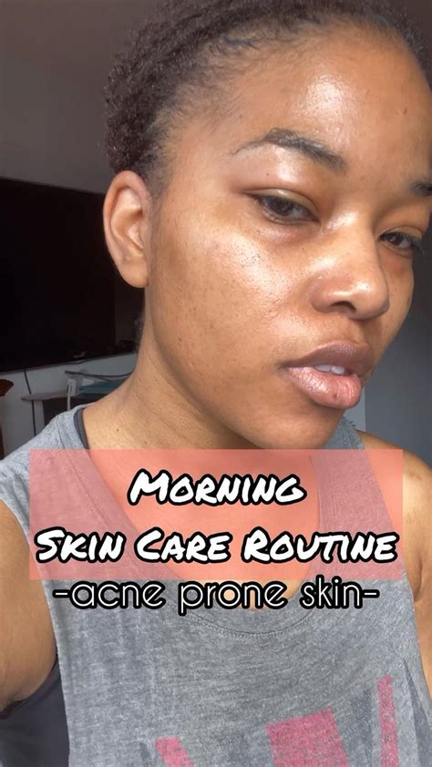 Acne Prone Morning Skincare Routine Skin Care Routine Morning Skin