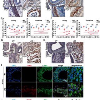 Depletion Of Kindlin In Adult Smooth Muscle Leads To Apoptosis A