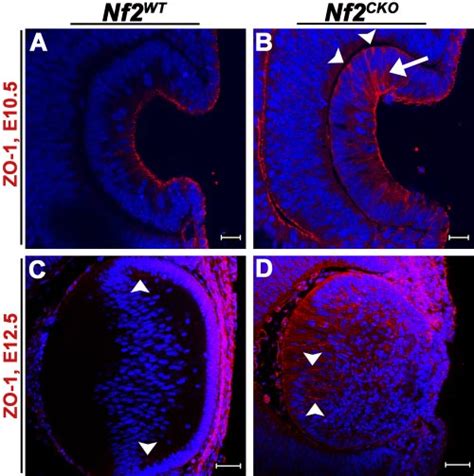 Nf2 Cko Lens Fiber Cells Retained Expression Of The Epithelial Cell Download Scientific Diagram