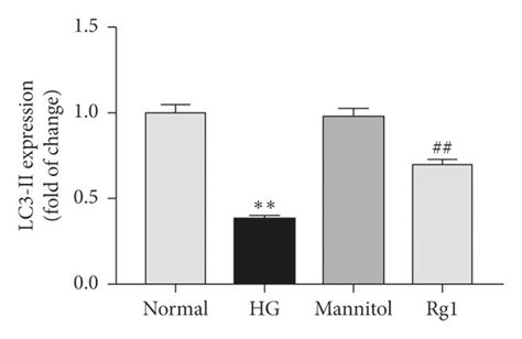 Effect Of Ginsenoside Rg On Autophagy Activity In Podocytes Under