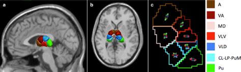 Robust Thalamic Nuclei Segmentation Method Based On Local Diffusion