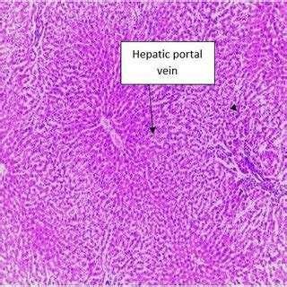 A Photomicrograph Of Liver Section From Group A Control Which Shows