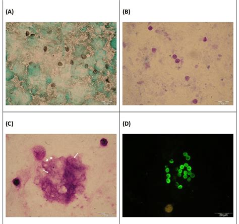 Rat And Human Respiratory Specimens With Pneumocystis After Proper Download Scientific Diagram