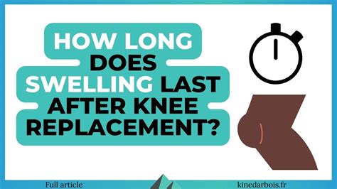 How Long Does Swelling Last After Knee Replacement Pictures