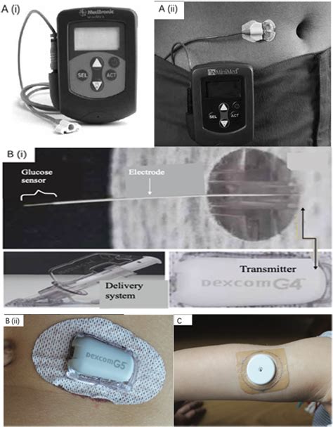 Commercialized wearable CGM devices. (A) The Medtronic MiniMed CGMS and ...