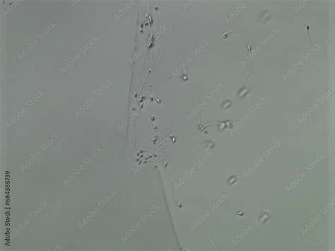 Overseeing the sperm cells under the laboratory clinic microscope. Sperm cells attaching to the ...